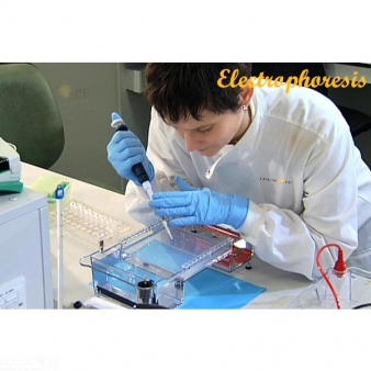 Electrophoresis
